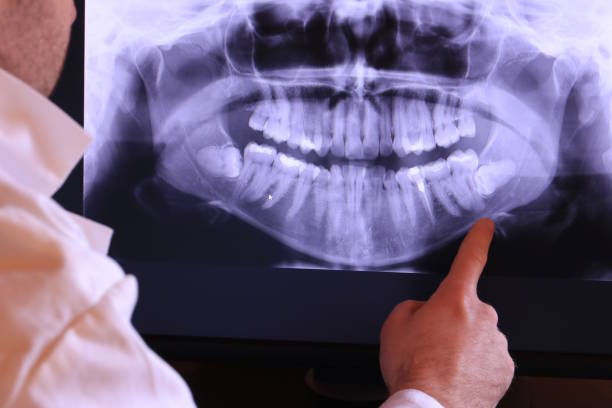 Best Emergency Treatment for Dental Infections or Abscesses in Woodland, WA