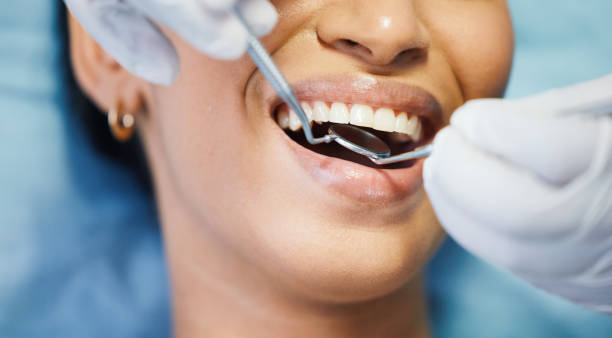 Best Emergency Root Canal Treatment in Woodland, WA